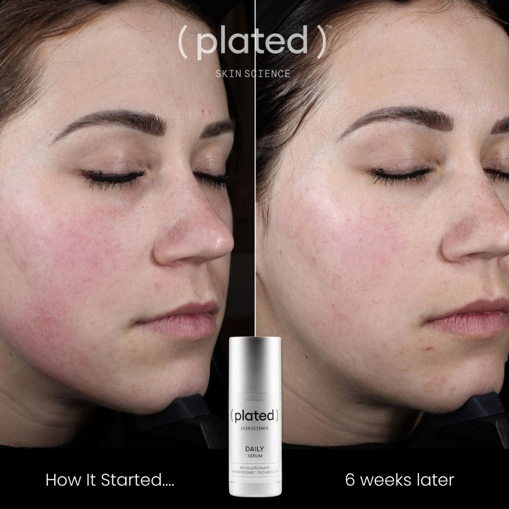 plated DAILY Serum – photo 3