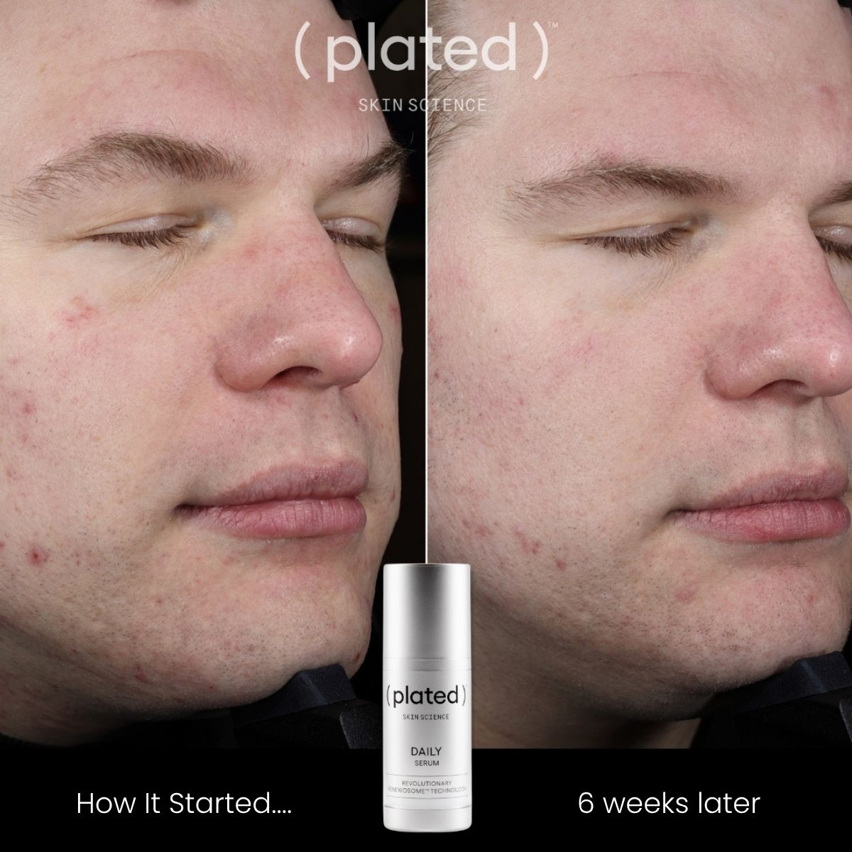 plated DAILY Serum – photo 4