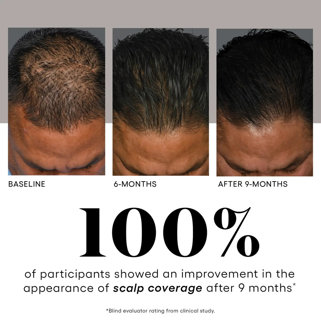 plated HAIR Serum – photo 4
