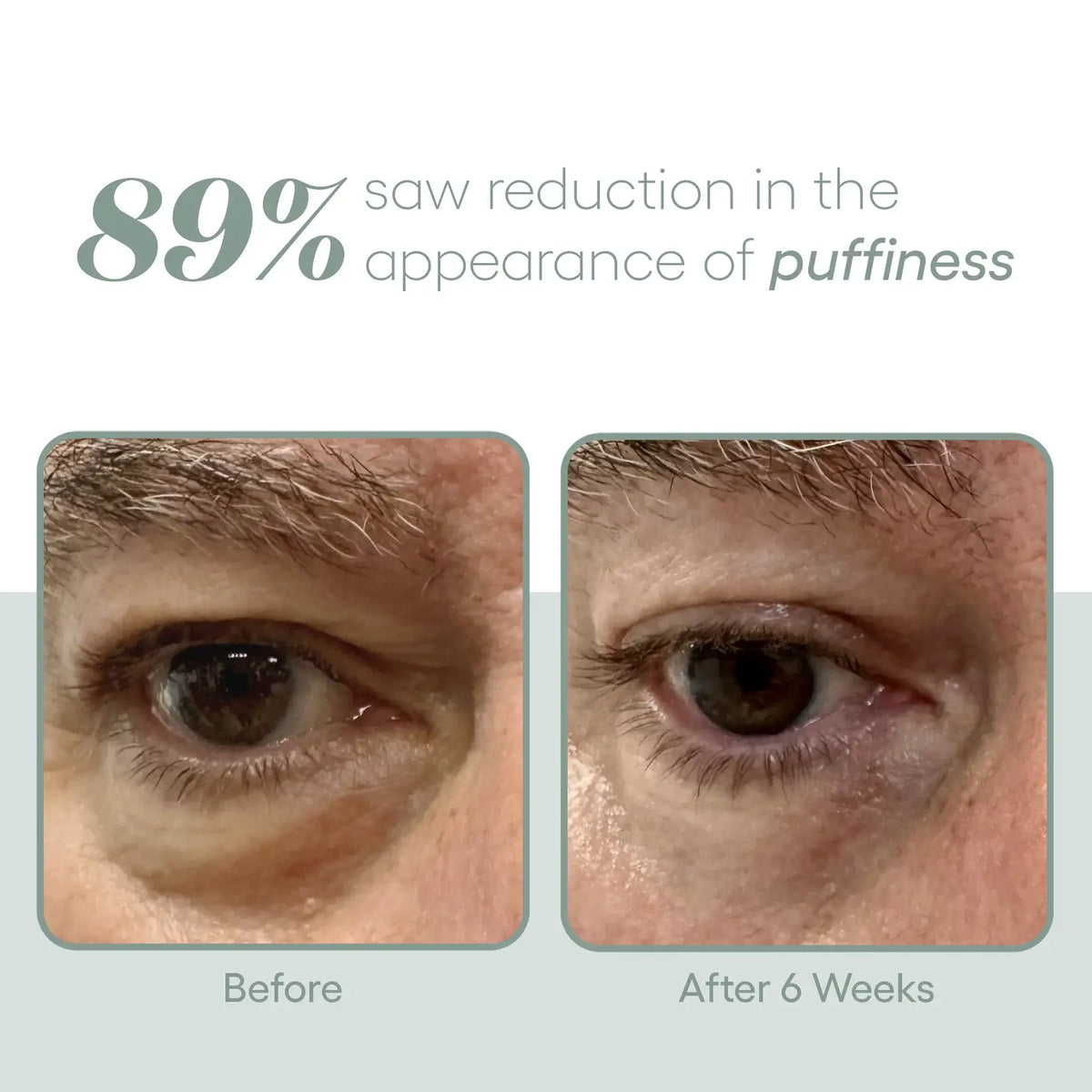 plated EYE Serum – photo 4