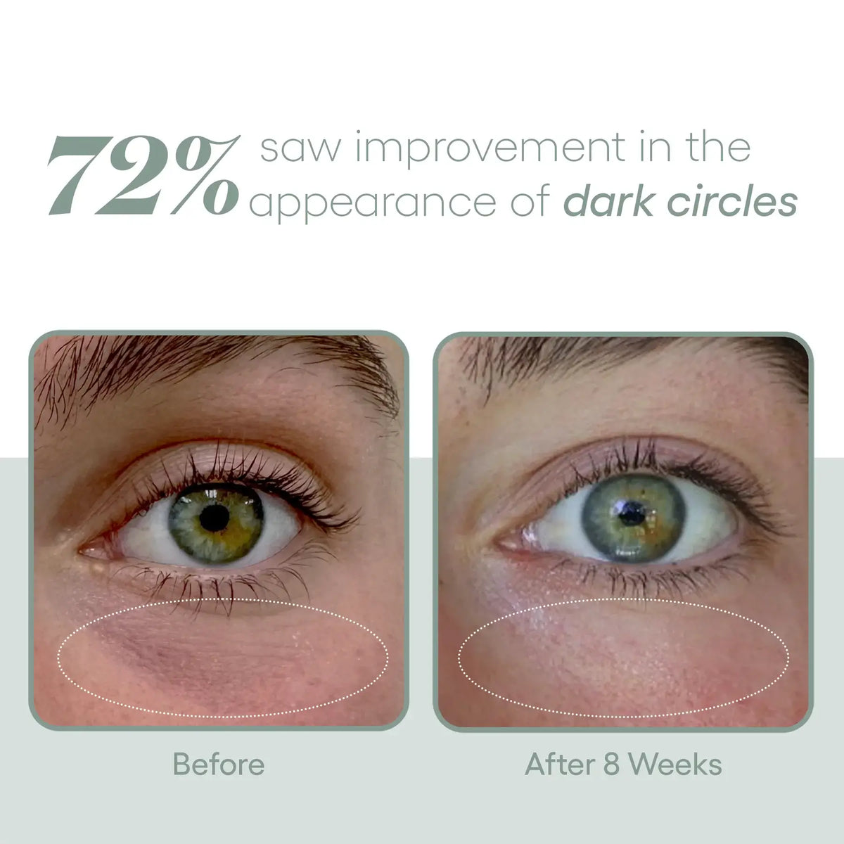 plated EYE Serum – photo 5