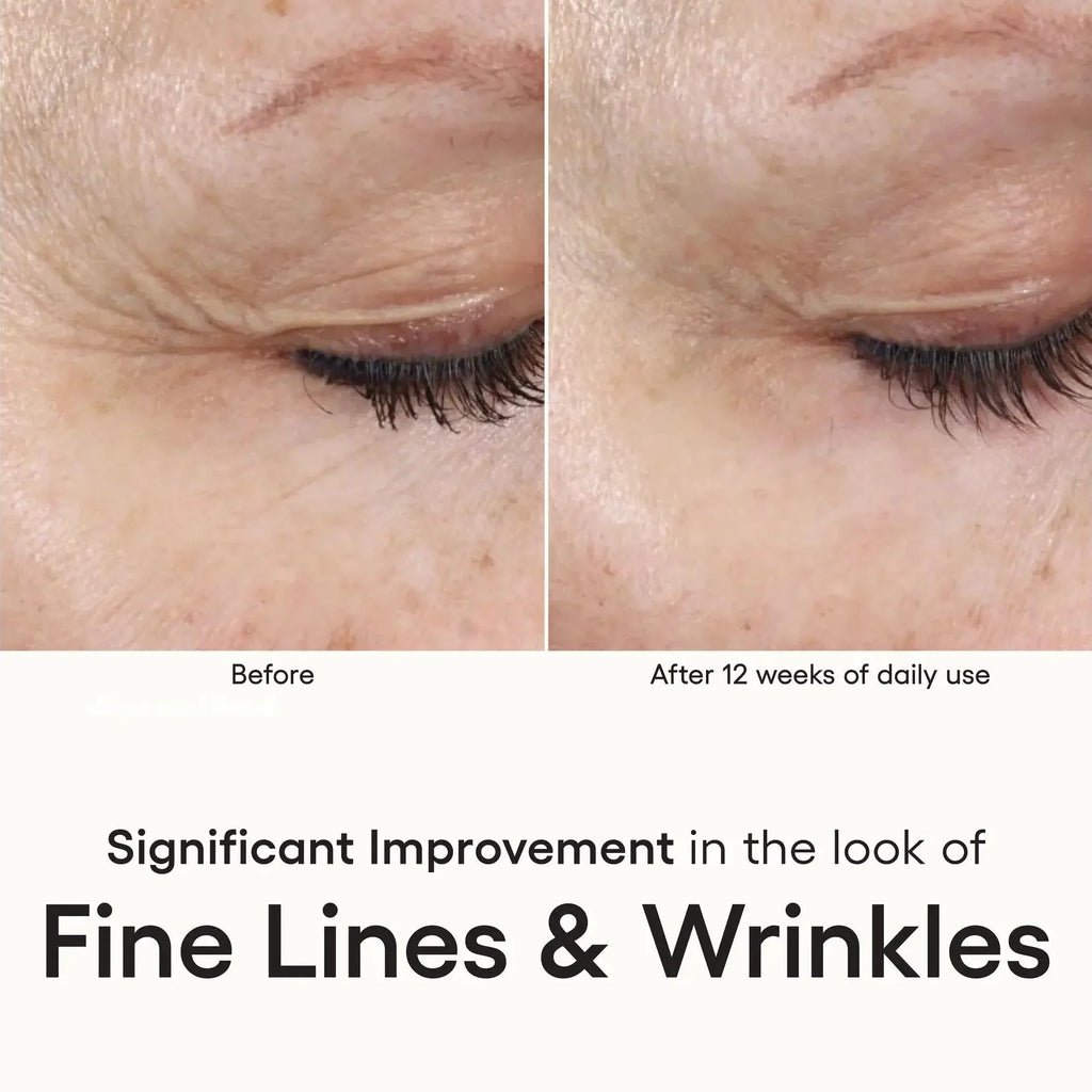plated INTENSE Serum – photo 5