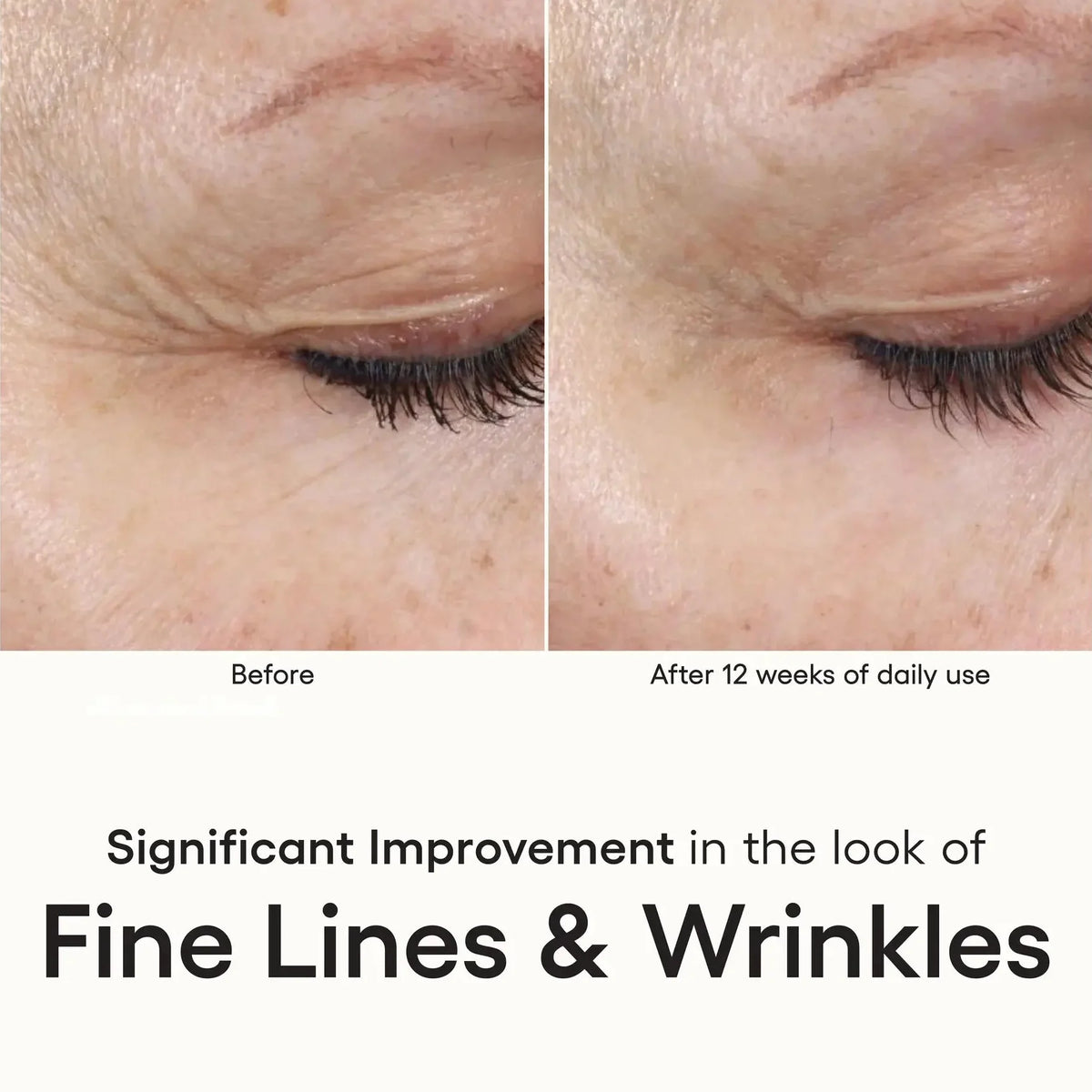 plated INTENSE Serum – photo 5